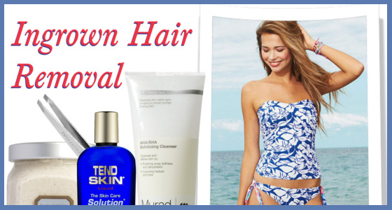 Ingrown Hair Removal - How To Get Rid of an Ingrown Hair
