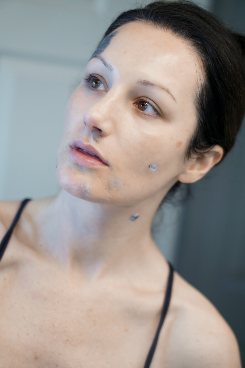 Anti-Acne Skin Guide and Expert Tips from Dermatologists