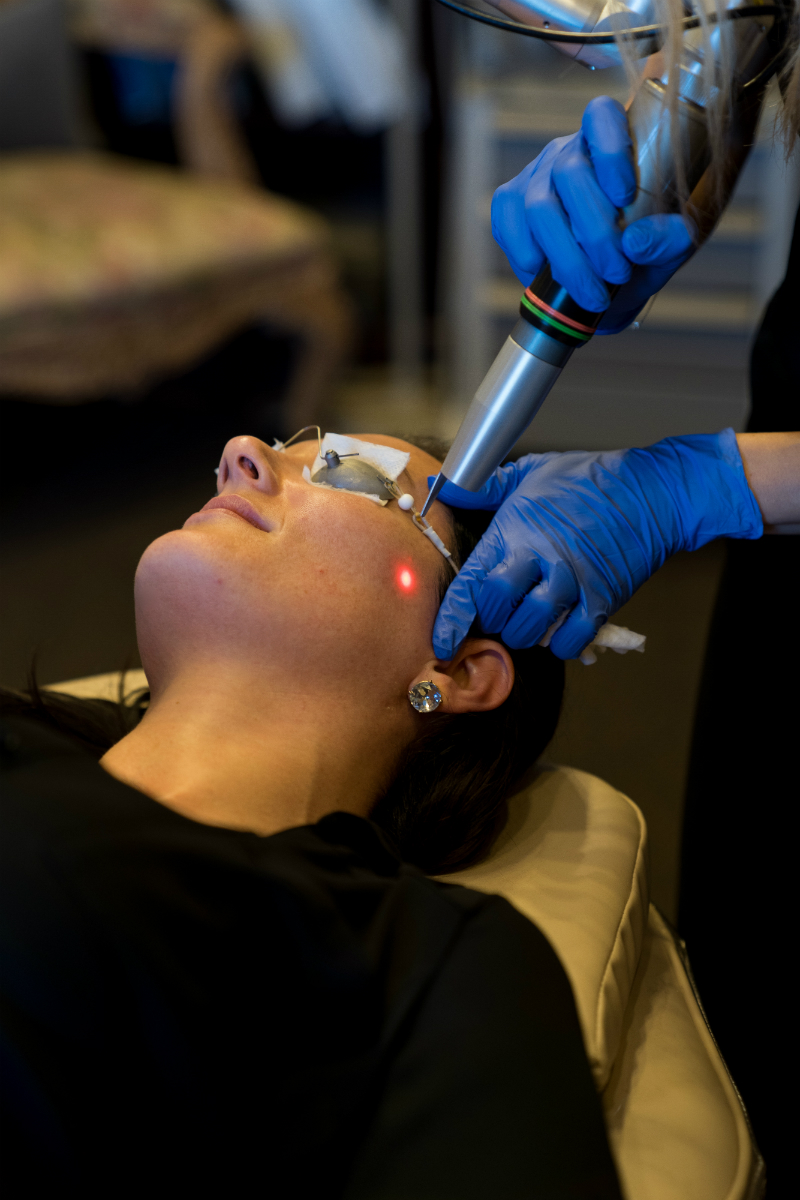 Face First Laser Skincare Series - What To Expect & How To Prepare